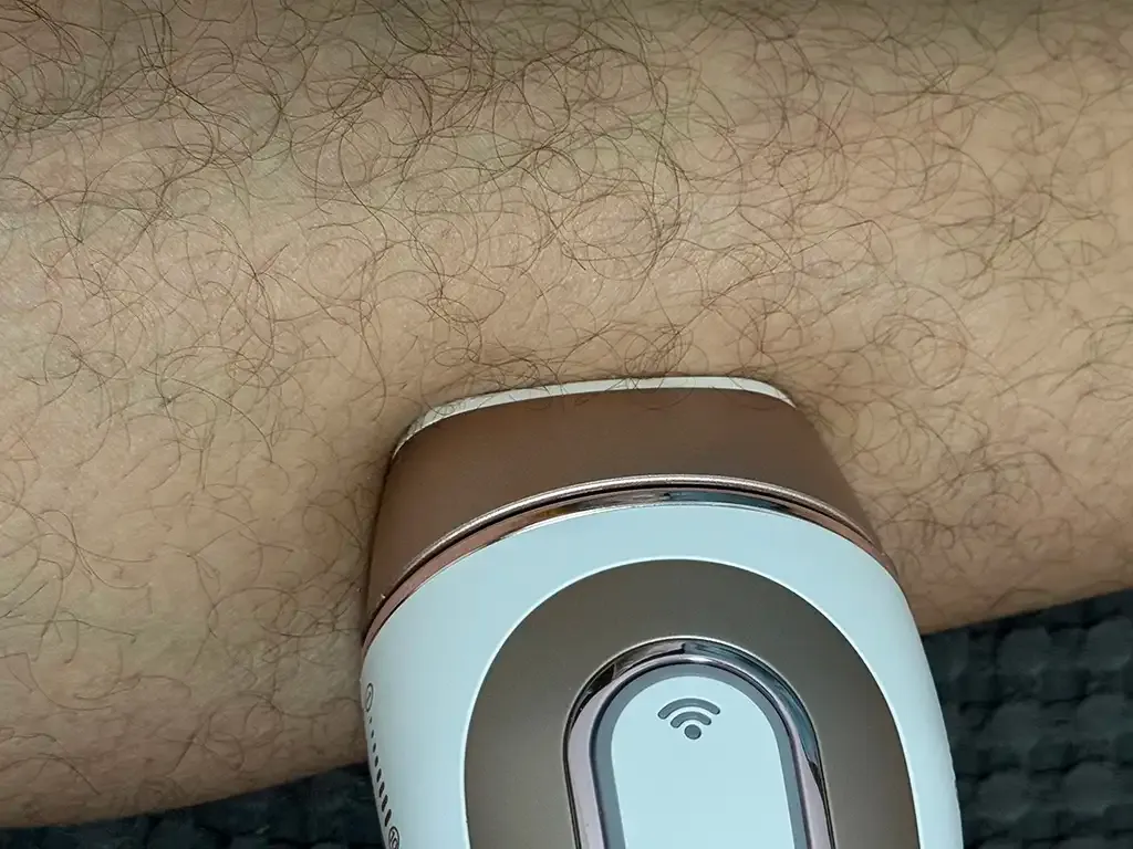 Aparat IPL folosit direct pe părul neras al piciorului — o greșeală frecventă la epilarea definitivă la bărbați